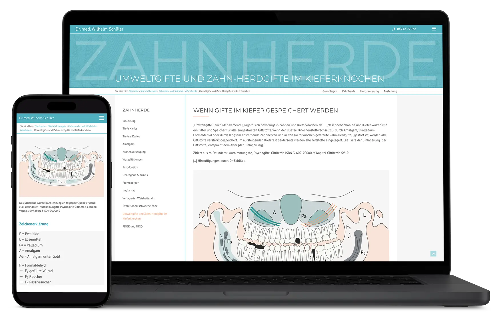 Responsive Website-Mockup auf Laptop und Smartphone: Webdesign für Dr. Wilhelm Schüler